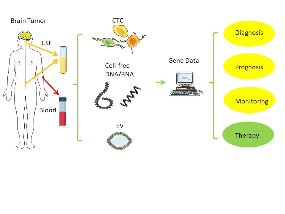 Encyclopedia_X's tweet image. 🔍Non-invasive techniques using cerebrospinal fluid (#CSF) to analyze biomarkers like #CTCs, #ctDNA, #miRNAs, and EVs offer insights into brain tumors, with CSF showing higher effectiveness than blood. Challenges in sensitivity and standardization persist. encyclopedia.pub/entry/15968