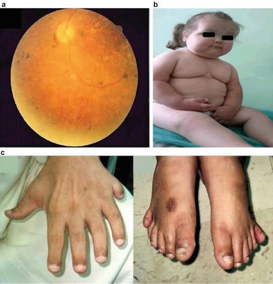 kolla_bharathi's tweet image. Diagnosis ? 
#MedTwitter 
#endotwitter