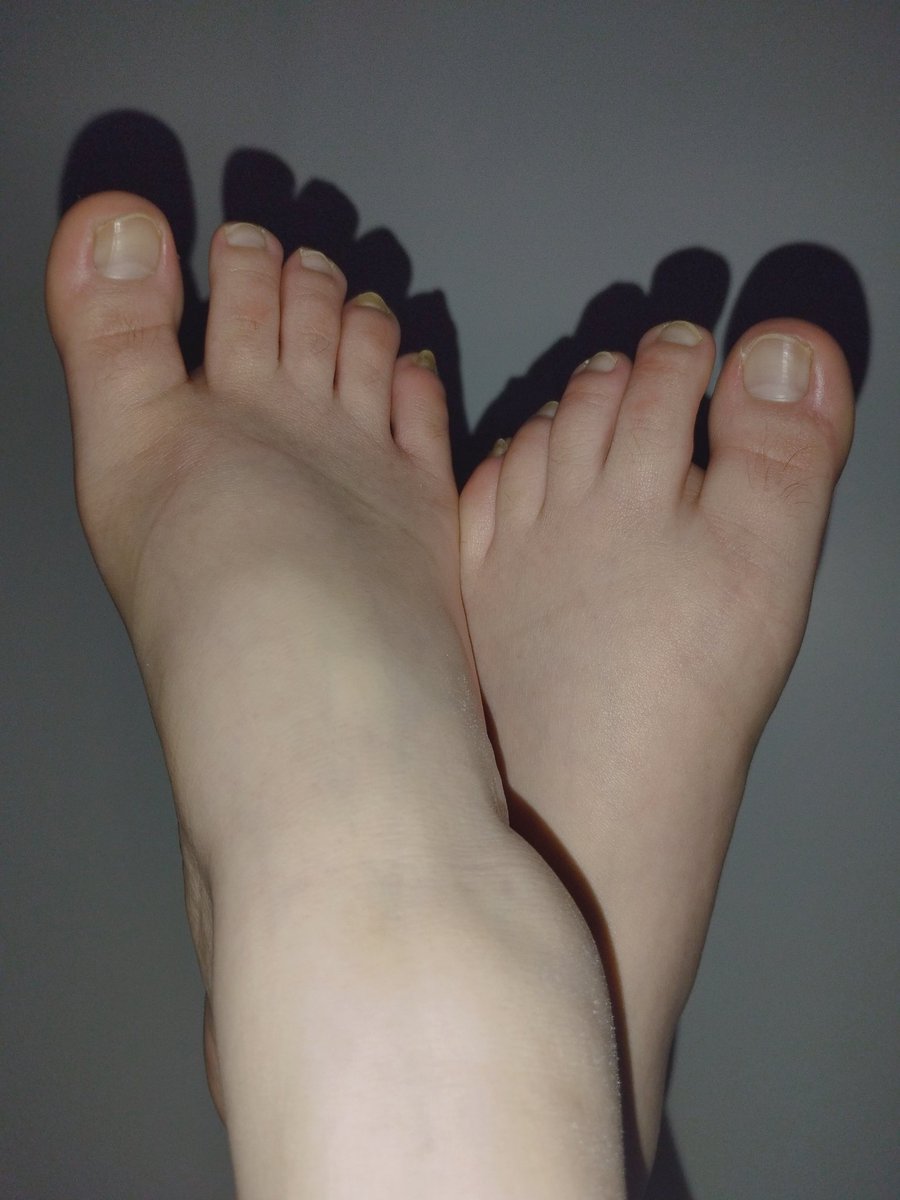 feetcolli's tweet photo. #GH16S #MasterChefCelebrity #Feet #feetworshi̇p #feetfetish #foot #footworshi̇p #feetpic #nsfwtwtًً https://t.co/zPdArIiOnO
