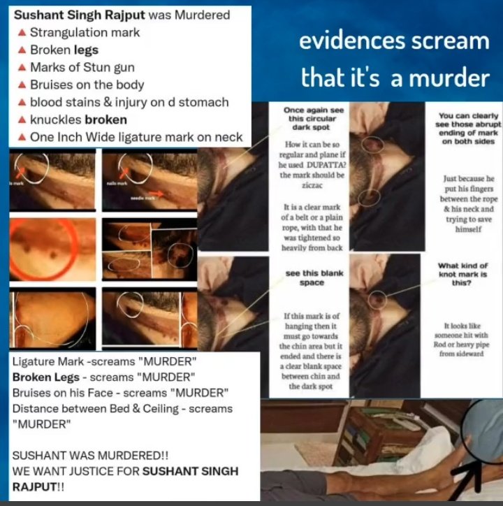 BanasreeDhar1's tweet image. We Want Justice InSSRCase
📌MURDER nt RULED OUT✅
👇
SSR FAINTED?
👇
Wanted2 XPOSE BIG in d &apos;PRESS
CONFERENCE&apos; afterDISHA?
👇
@MumbaiPolice S THEORY❌
📌MVA GONE &amp;amp;
PITHANI GOT BAIL?
Y ws he ALLOWED 2 STAY atMB
after SSR MURDER?👈
@CBIHeadquarters
@narendramodi
#ArrestSandeepSingh