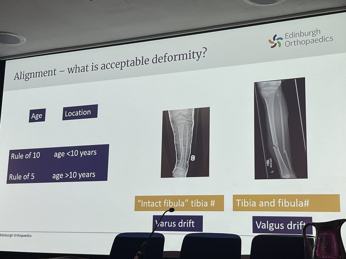 <a href="/PaedsOrthopod/">Jürgen Messner</a> and the “rule of 10” for paeds tibia fracture <a href="/BritOrthopaedic/">BOA</a> #Hall11