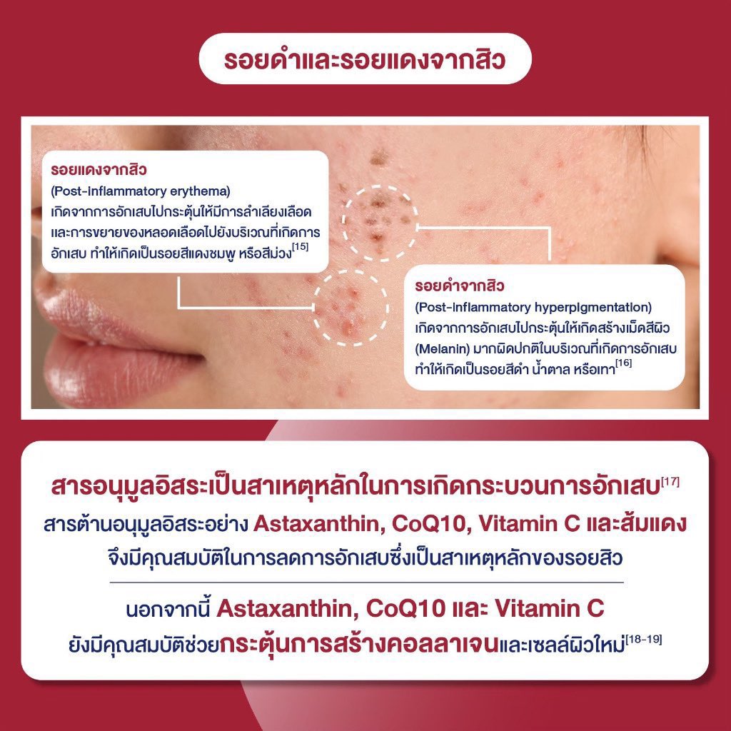 pinthanthong1's tweet image. 🍒 Nectapharma : Astaxanthin + CoQ10 ของแท้แน่นอน 
🎀 แกะทานไป 1 เม็ด

⭐️ 690 ( รวมส่งแล้วค่ะ) 

💟 หมดอายุ 12/07/2025 (ปีหน้า)
สนใจ dm มาได้ค่ะ 

#ส่งต่อnectapharma #nectapharmaส่งต่อ #nectapharma #astaxanthin #astareal #ส่งต่อวิตามิน #ส่งต่อสกินเเคร์ #ส่งต่อคสอ #ส่งต่อglory