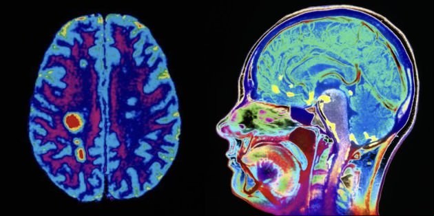 brianmaierhofer's tweet image. I’m 32.

Stress controlled me for years so I turned to holistic psychology.

After 2000+ hours of clinical training as a therapist, my toolkit is now full of powerful mind-body healing hacks.

Here are the top 7 that will change your life: 🧵