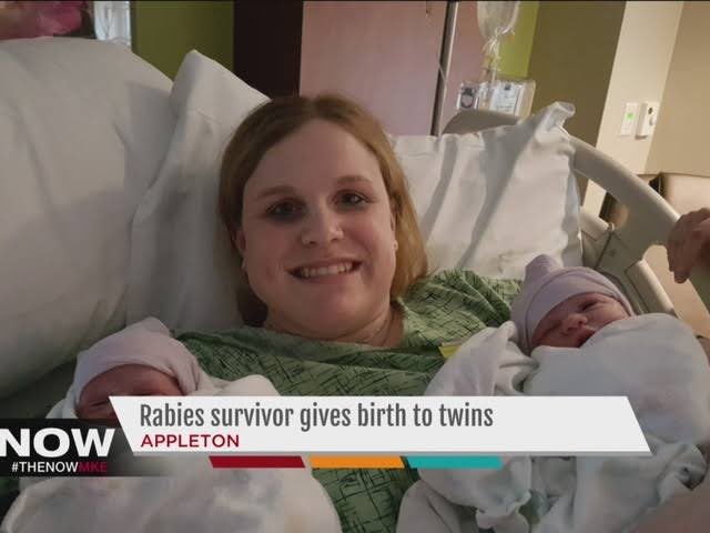 Jeanna Giese, the first human known to have survived Rabies in 2004. The Wisconsin born lady recently gave birth to twins.

Her survival was attributed to the use of the “Milwaukee protocol”. A treatment involving putting her into a drug induced coma and giving antiviral drugs.