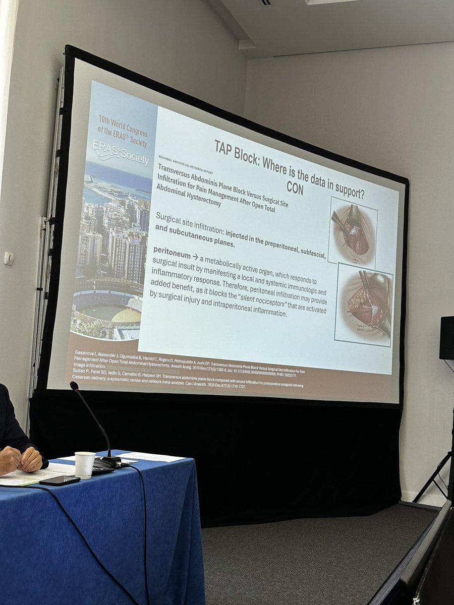 GreggNelsonERAS's tweet image. Pro vs Con #ERAS debates 🥊 with @BonaldoGiulio and @Pan_Teresa_MD #carbload #TAPblock #drains @ErasSociety @pedroramirezMD