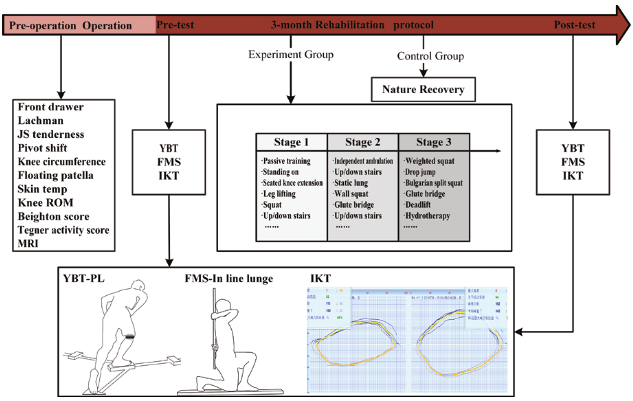 Three-month functional training programme improves knee joint function in athletes post-ACL reconstruction surgery
Chuanjia Du et al.
#anteriorcruciateligament #balance #stability #musclesactivation #strength
doi.org/10.2340/jrm.v5…