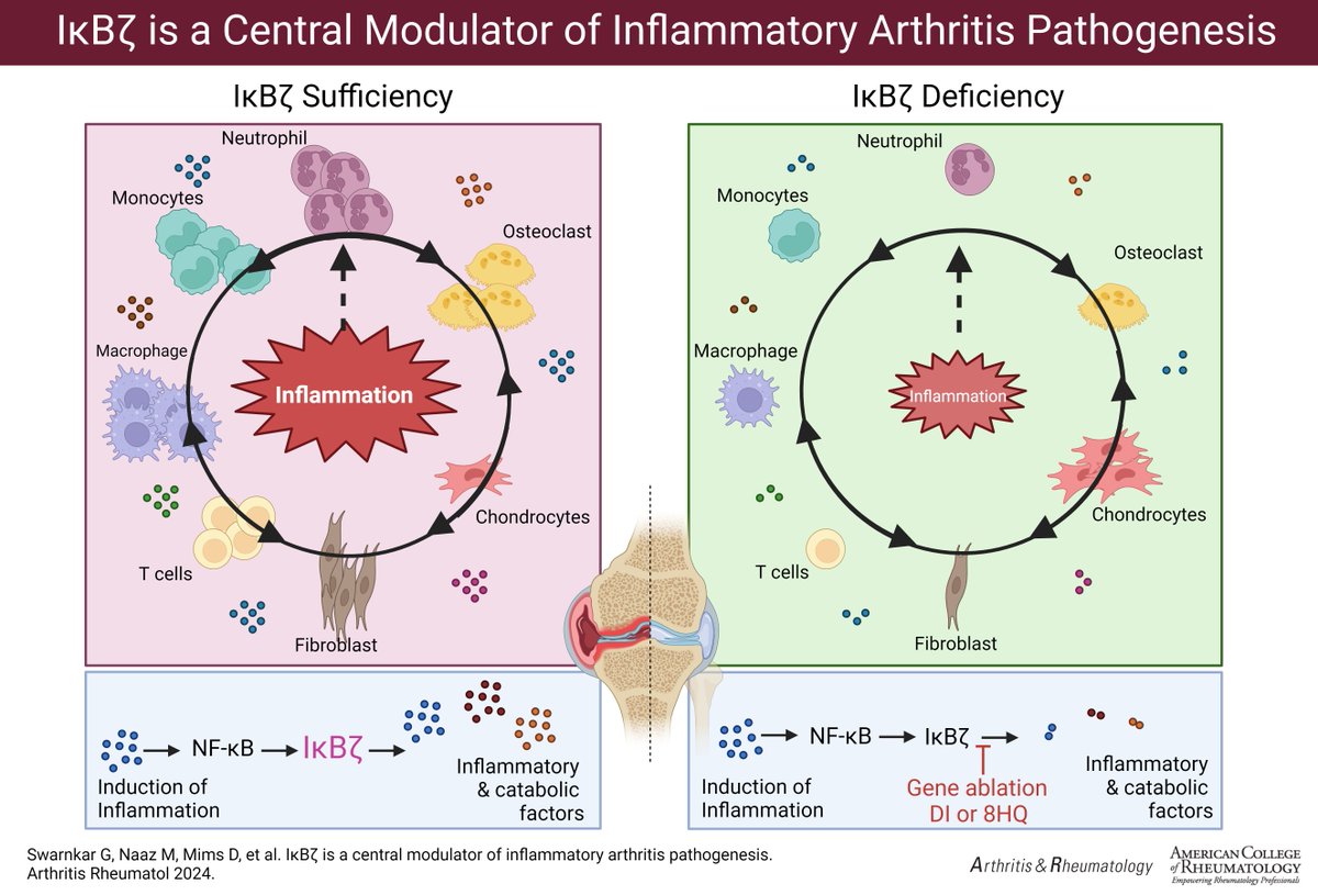 ACR_Journals's tweet photo. This study identified the transcription factor IkBzeta (IĸBζ) as key regulator of inflammation in the synovial joint. Genetic and pharmacologic approaches showed that blocking IĸBζ diminishes inflammatory arthritis in mice.

In A&amp;R
https://t.co/w1jb5TS2Ux
@abuamer_lab https://t.co/CN22ESoZxr