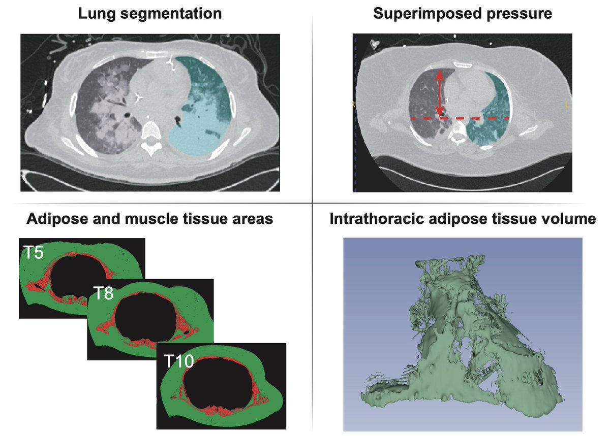 Stefano Spina tweet media