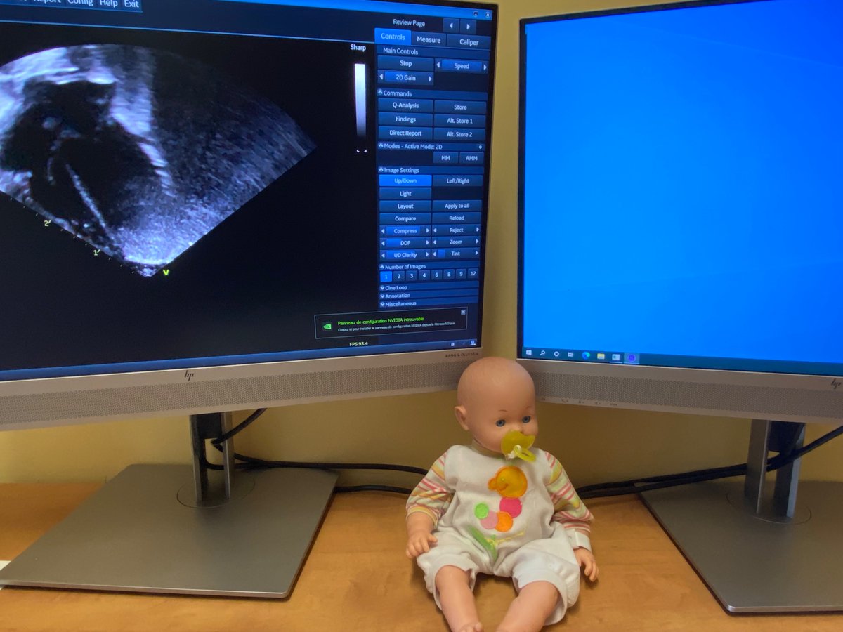 You know you work in the NICU when…
You find babies  at random places