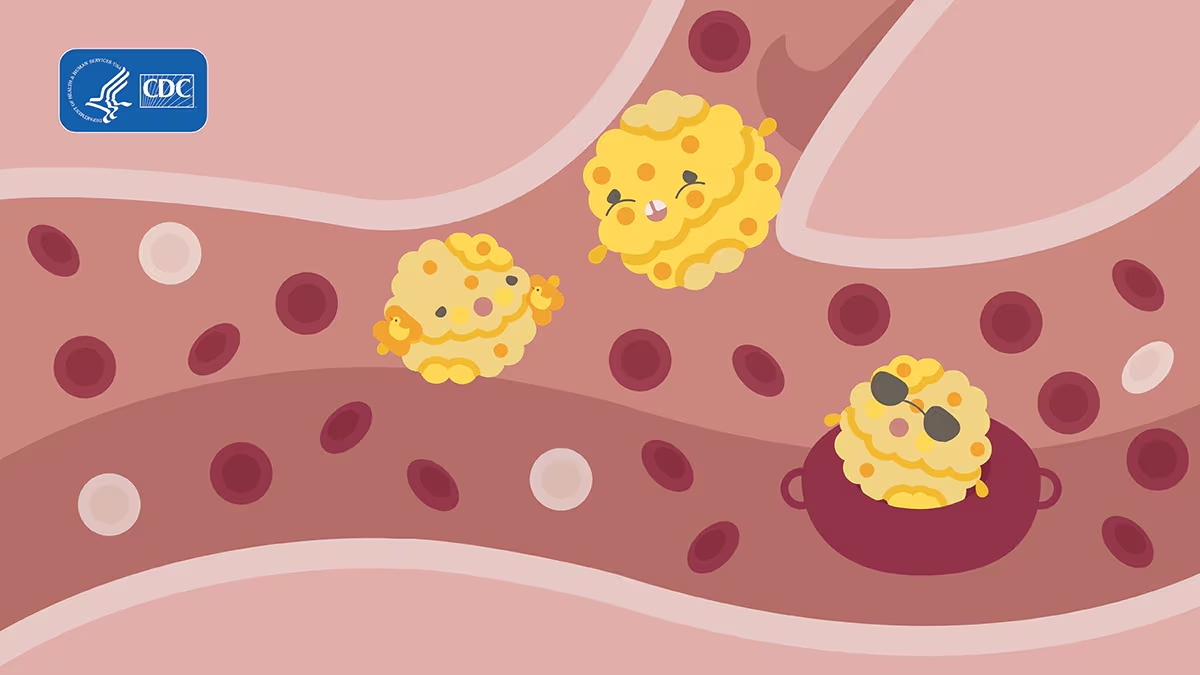 It's National Cholesterol Education Month! There are two types of blood cholesterol: LDL ("bad") and HDL ("good"). Too much LDL cholesterol or not enough HDL cholesterol in the body can cause a buildup, called "plaque", on the walls of blood vessels. bit.ly/2kxTyCA