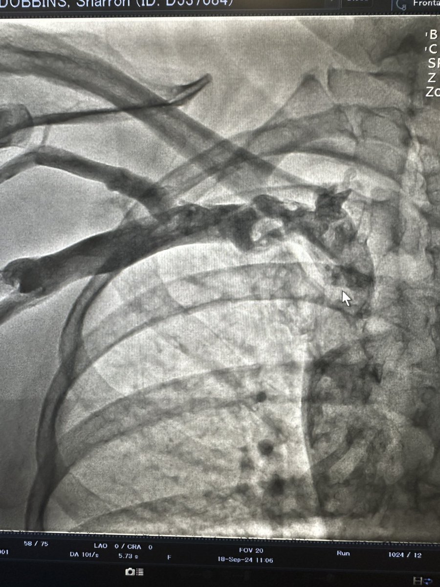 Fraser Witherow tweet media