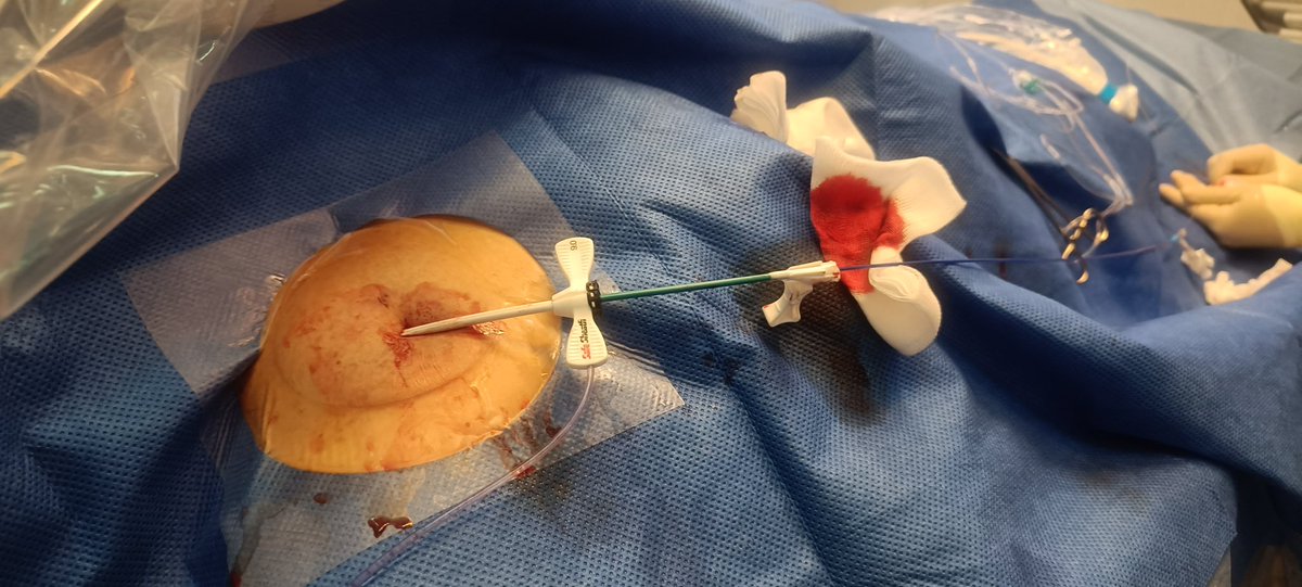 Fraser Witherow tweet media