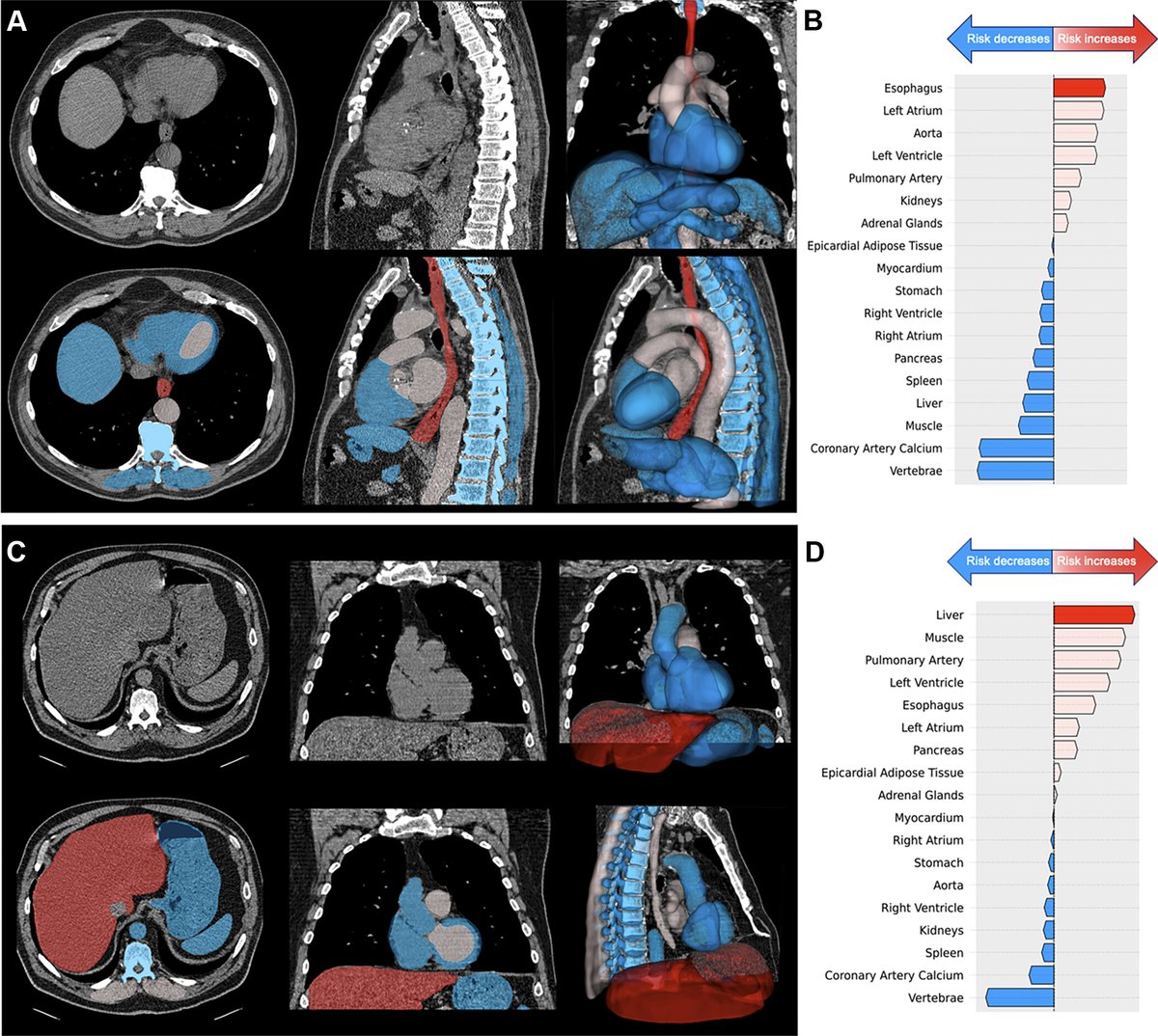AI indicates extrapulmonary structures at risk on chest CT scans and predicts mortality with explanations.  <a href="/radiology_rsna/">Radiology</a> 
lnkd.in/gmzmMbPN