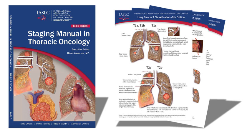 The updated #IASLC tumor, node, metastasis (TNM) staging recommendations for #lungcancer, thymic tumors &amp; mesothelioma are now available &amp; are described in new editions of the IASLC Staging Cards &amp; the Staging Manual in Thoracic Oncology. Order/download: bit.ly/IASLCStagingTNM