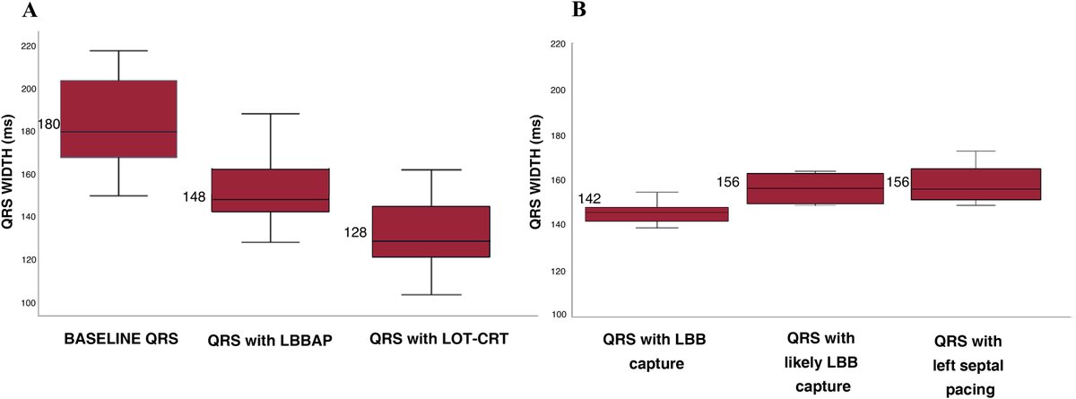 REC Publications (@revespcardiol) on Twitter photo Optimized left bundle branch cardiac resynchronization therapy: effects on electrocardiogram and left ventricular function. #REC #AheadOfPrint <a href="/carmenarveras/">Carmen Arveras</a> <a href="/rosellovp/">Víctor Pérez Roselló</a> <a href="/GunturizC/">ClaraGunturiz</a> revespcardiol.org/en-optimized-l… Optimized left bundle branch cardiac resynchronization therapy: effects on electrocardiogram and left ventricular function. #REC #AheadOfPrint <a href="/carmenarveras/">Carmen Arveras</a> <a href="/rosellovp/">Víctor Pérez Roselló</a> <a href="/GunturizC/">ClaraGunturiz</a> revespcardiol.org/en-optimized-l…