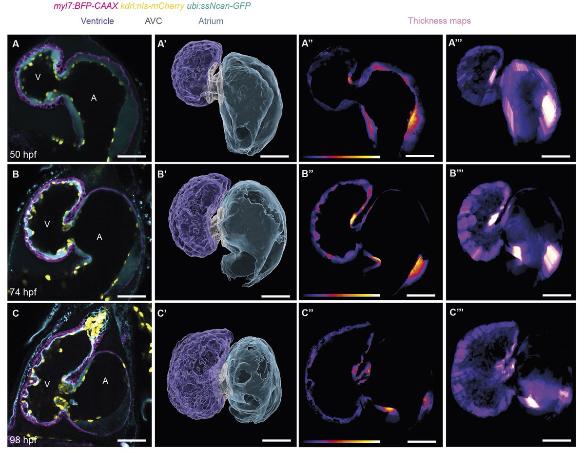 NAVBO (@vascularbiology) on Twitter photo #NAVBO Member Publication Alert
#Zebrafish🐟🫀
Mechanical forces remodel the cardiac extracellular matrix during zebrafish development
by Didier Stainier & Felix Gunawan groups <a href="/Dev_journal/">Development</a> <a href="/StainierLab/">Stainier Lab</a> <a href="/GunawanLab/">Felix_Gunawan 🏳️🌈</a>
journals.biologists.com/dev/article/15… #NAVBO Member Publication Alert
#Zebrafish🐟🫀
Mechanical forces remodel the cardiac extracellular matrix during zebrafish development
by Didier Stainier & Felix Gunawan groups <a href="/Dev_journal/">Development</a> <a href="/StainierLab/">Stainier Lab</a> <a href="/GunawanLab/">Felix_Gunawan 🏳️🌈</a>
journals.biologists.com/dev/article/15…