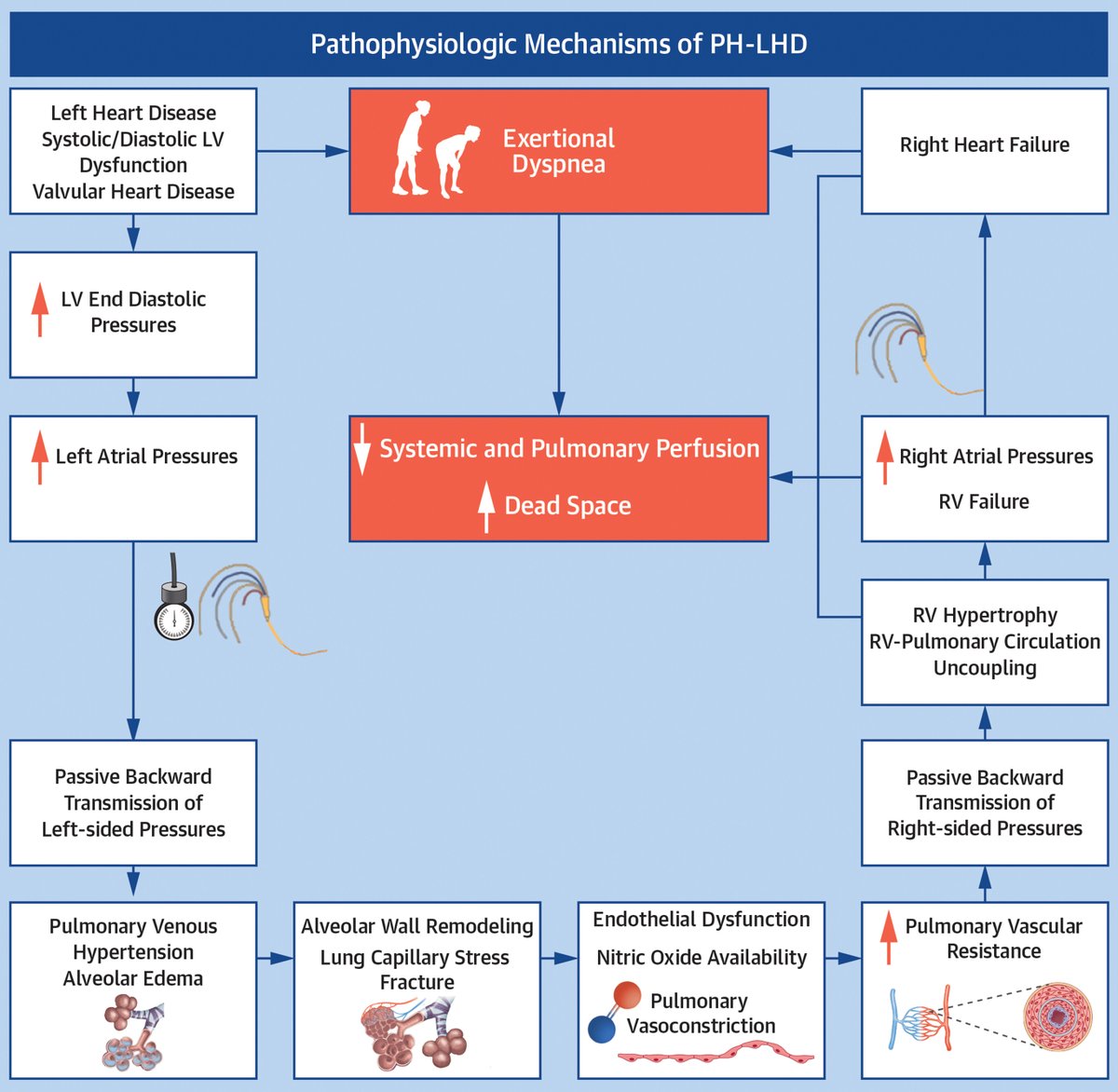 JACC Journals (@jaccjournals) on Twitter photo Pulmonary hypertension (PH) due to left heart disease is the most prevalent cause of PH. It's complex to diagnose & manage, often underdiagnosed in older adults. Accurate testing & early detection are key to better outcomes. More: bit.ly/3XMFeYJ
#JACCHF #cvPAH Pulmonary hypertension (PH) due to left heart disease is the most prevalent cause of PH. It's complex to diagnose & manage, often underdiagnosed in older adults. Accurate testing & early detection are key to better outcomes. More: bit.ly/3XMFeYJ
#JACCHF #cvPAH