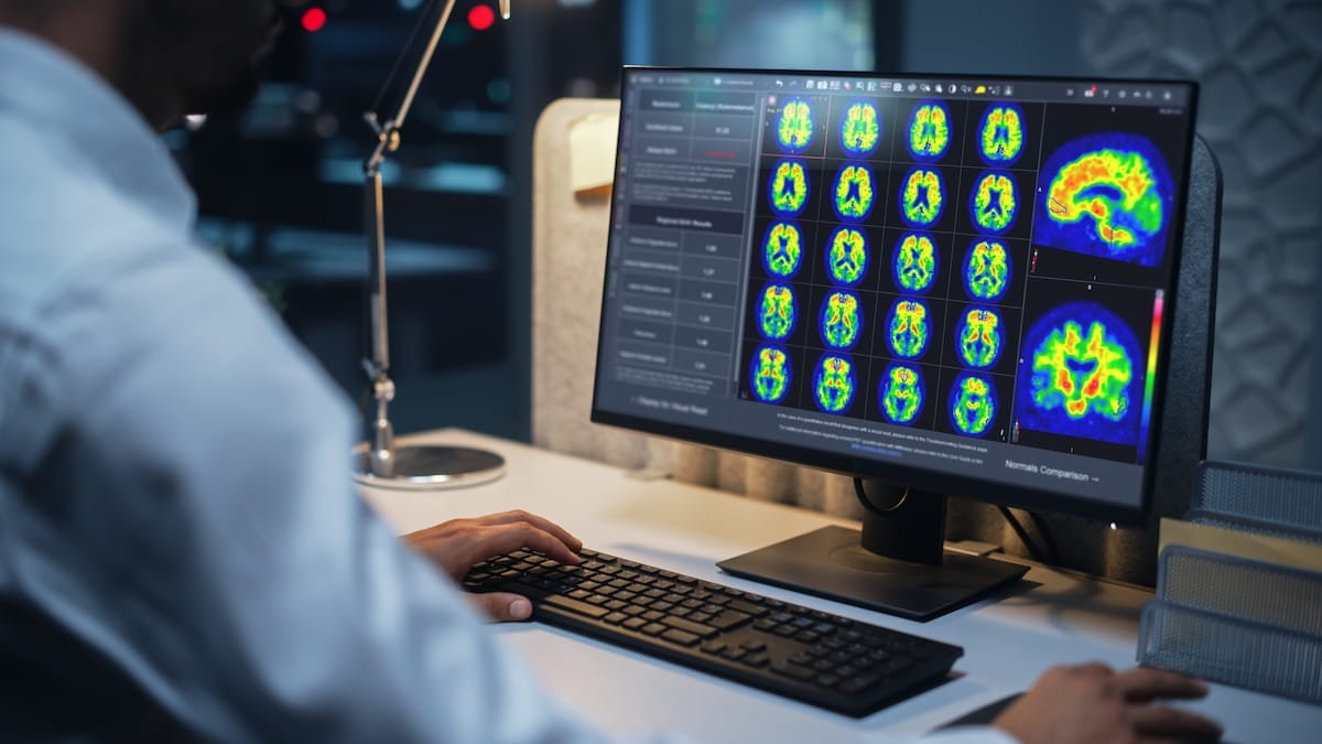 Diagnostic Imaging (@dx_imaging) on Twitter photo FDA Clears PET-Based Software for Centiloid Scaling of #Amyloid Plaque Density
diagnosticimaging.com/view/fda-clearā¦
<a href="/ACRRFS/">ACR RFS - We've Moved! Follow <a href="/RadiologyACR/">American College of Radiology</a>.</a> <a href="/ACRYPS/">ACR YPS- We've Moved! Follow @RadiologyACR.</a> @RadiologyACR <a href="/ARRS_Radiology/">ARRS</a> <a href="/TheASNR/">The American Society of Neuroradiology</a> <a href="/theASFNR/">American Society of Functional Neuroradiology</a> @USCneurorads <a href="/UCLANeurorads/">UCLA Neuroradiology</a> <a href="/UCSFimaging/">UCSF Imaging</a> <a href="/OHSURadiology/">OHSU Radiology</a> <a href="/UofURadiology/">UofURadiology</a>
#radiology #RadRes #neuroradiology FDA Clears PET-Based Software for Centiloid Scaling of #Amyloid Plaque Density
diagnosticimaging.com/view/fda-clearā¦
<a href="/ACRRFS/">ACR RFS - We've Moved! Follow <a href="/RadiologyACR/">American College of Radiology</a>.</a> <a href="/ACRYPS/">ACR YPS- We've Moved! Follow @RadiologyACR.</a> @RadiologyACR <a href="/ARRS_Radiology/">ARRS</a> <a href="/TheASNR/">The American Society of Neuroradiology</a> <a href="/theASFNR/">American Society of Functional Neuroradiology</a> @USCneurorads <a href="/UCLANeurorads/">UCLA Neuroradiology</a> <a href="/UCSFimaging/">UCSF Imaging</a> <a href="/OHSURadiology/">OHSU Radiology</a> <a href="/UofURadiology/">UofURadiology</a>
#radiology #RadRes #neuroradiology
