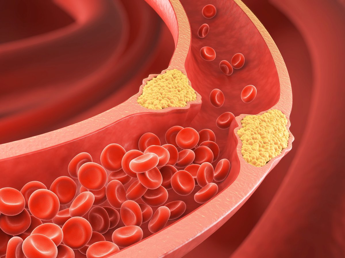 Colesterol: cuál es tu meta de LDL, la trampa de los valores de referencia y por qué el bueno "murió" dlvr.it/TDQ1JV