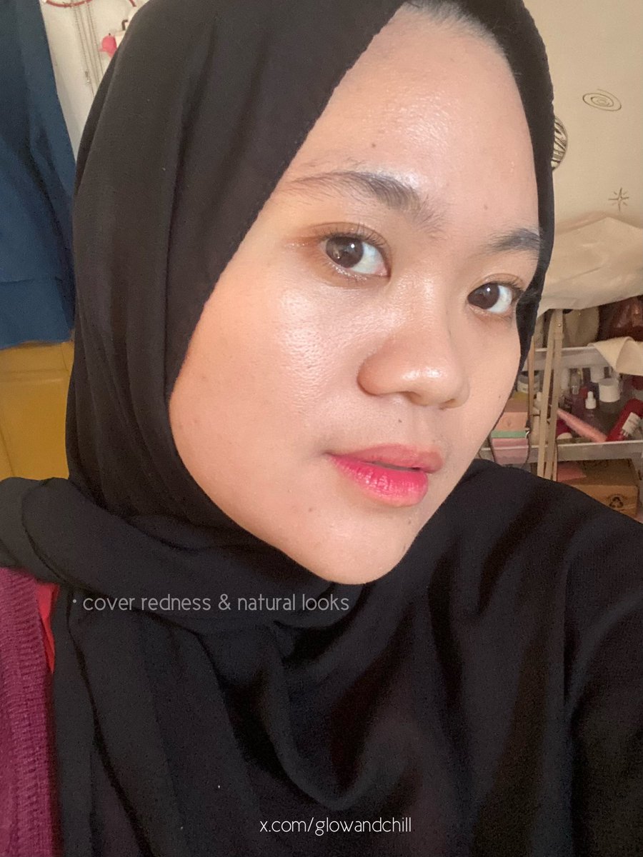 glowandchill's tweet photo. Tinted sunscreen adalah solusi banget buat aku yang mager makeup 🫱🏻‍🫲🏼

Bikin keliatan fresh tapi tetep ringan &amp; TERLINDUNGI dari teriknya matahari ☀️🕶️

Buat nutupin redness oke banget ☑️ https://t.co/URZY1z8j2X