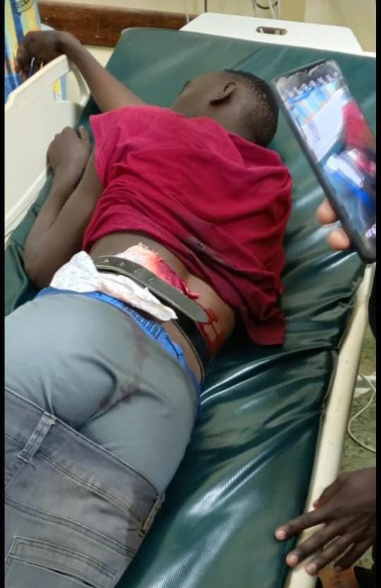 Mabonga_254's tweet photo. A Moi University comrade shot for demanding education—is this the price we pay for justice? No student should face violence for standing up for their future. We demand accountability and justice NOW! #JusticeForComrades #EndPoliceBrutality https://t.co/qupJUD1pd3