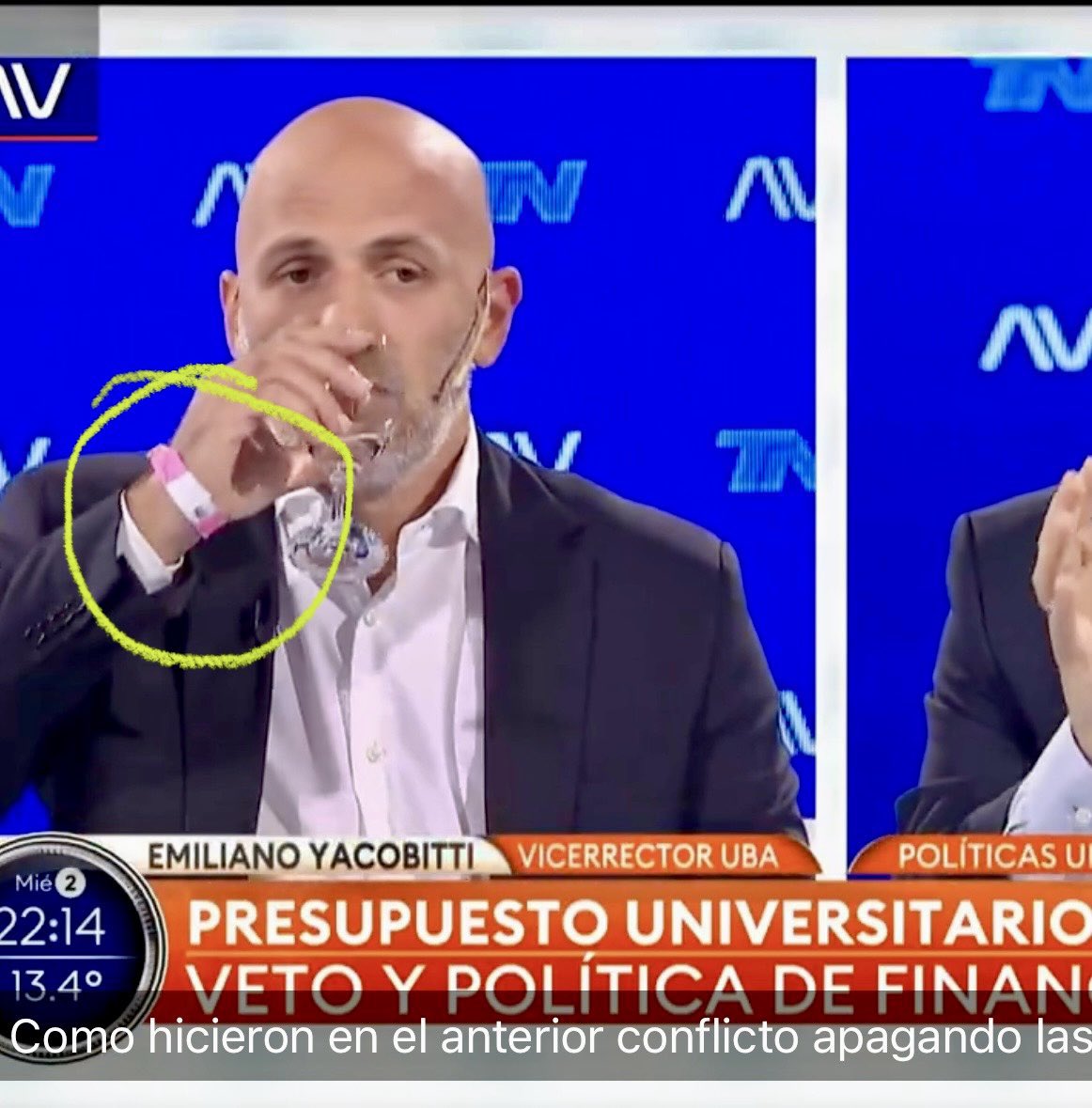 atlanticsurff's tweet photo. Entienden que Yacobitti fue a TN a decir que Milei no le da plata para la UBA, recién llegado de sus vacaciones en Miami y ni siquiera se sacó la pulsera de all inclusive donde estuvo hospedado. Así se te ríe en la cara.👇👊💣 https://t.co/uAMhzg2oKz