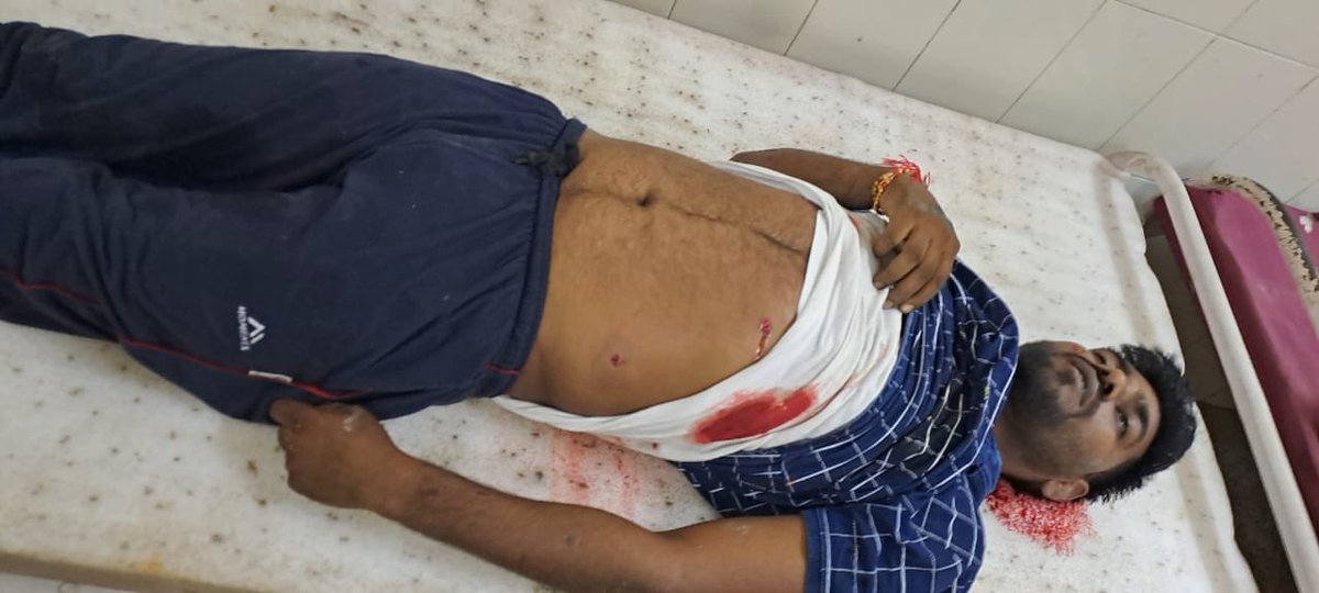 “चेतावनी- तस्वीरें वीभत्स हैं”

अमेठी में बदमाशों ने घर मे घुसकर टीचर समेत पूरे परिवार की हत्या की। स्कूल टीचर उनकी पत्नी और उनके दोनों बच्चों के मौके मौत की सूचना। किराए के मकान में अपने परिवार के साथ रहता था परिवार। शिवरतनगंज थाना क्षेत्र के भवानी नगर चौराहे का मामला।