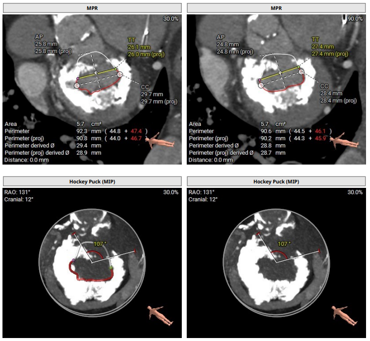 Gennaro Giustino, MD tweet media