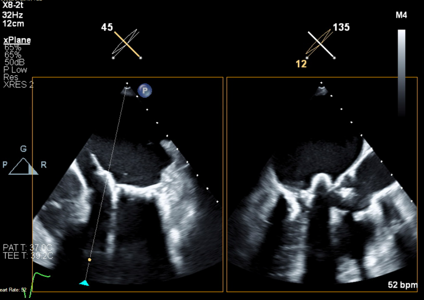 Gennaro Giustino, MD tweet media