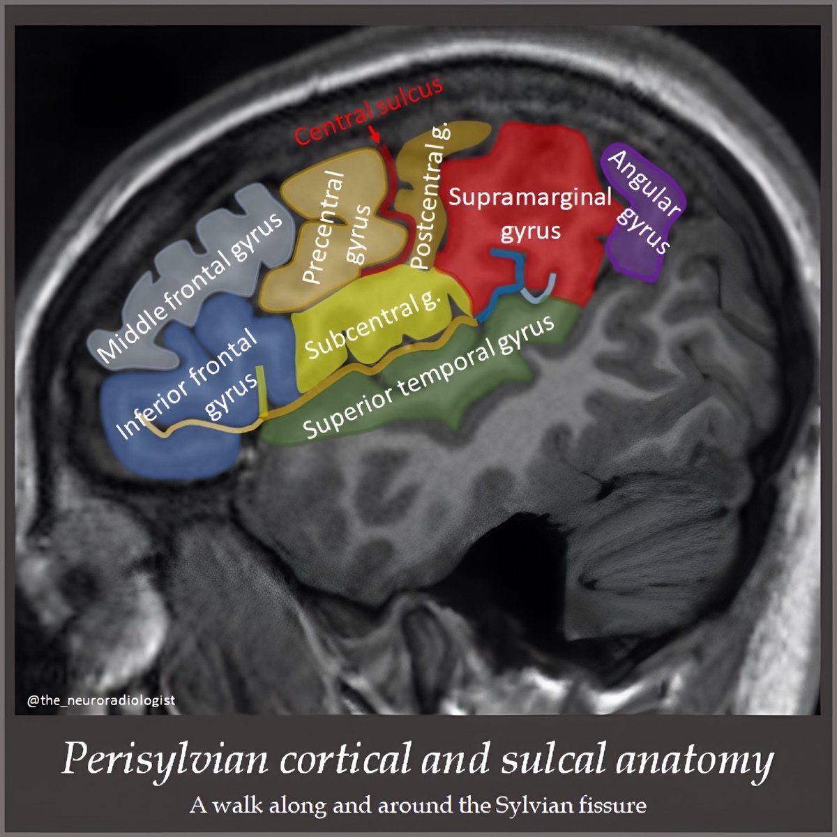 ZaAli38's tweet photo. Surface anatomy 

Brain https://t.co/70n6bLfyYE