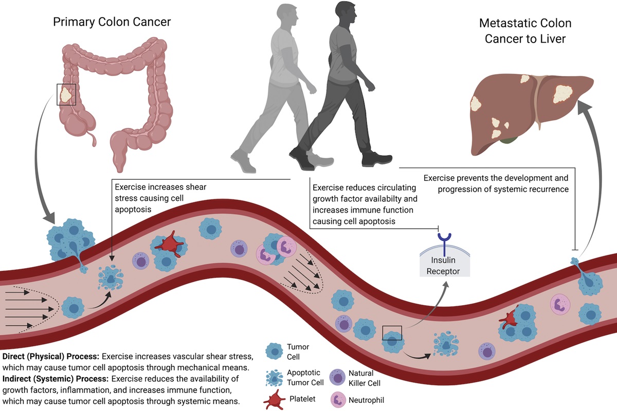 ESSRonline's tweet photo. Physical activity may reduce the risk of metastatic disease recurrence and mortality in cancer patients through two synergistic processes.

Today's #tbt article: https://t.co/MBCB6hoIrk https://t.co/Cb8U6KDj8Y