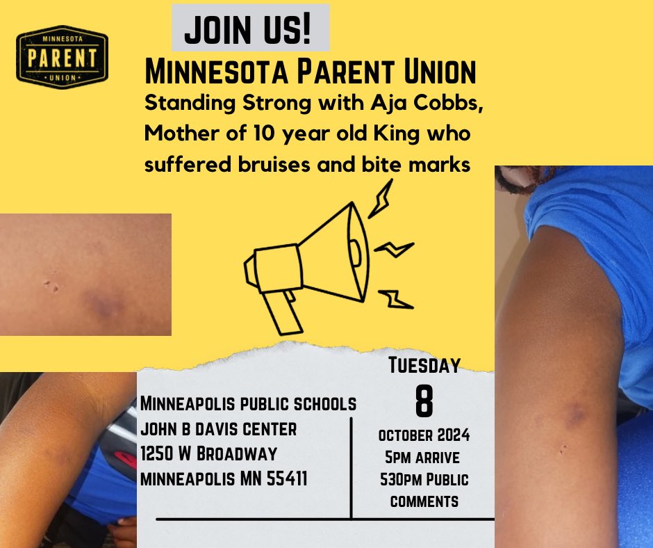 We’re going to keep demanding justice for King until justice is served. Show up and support Aja Cobbs, Mother of 10 year old King who suffered bruises and bite marks. 

Tuesday October 8, 2024 5pm at Minneapolis Public Schools John B Davis Ctr 1250 W Broadway, Minneapolis 55411