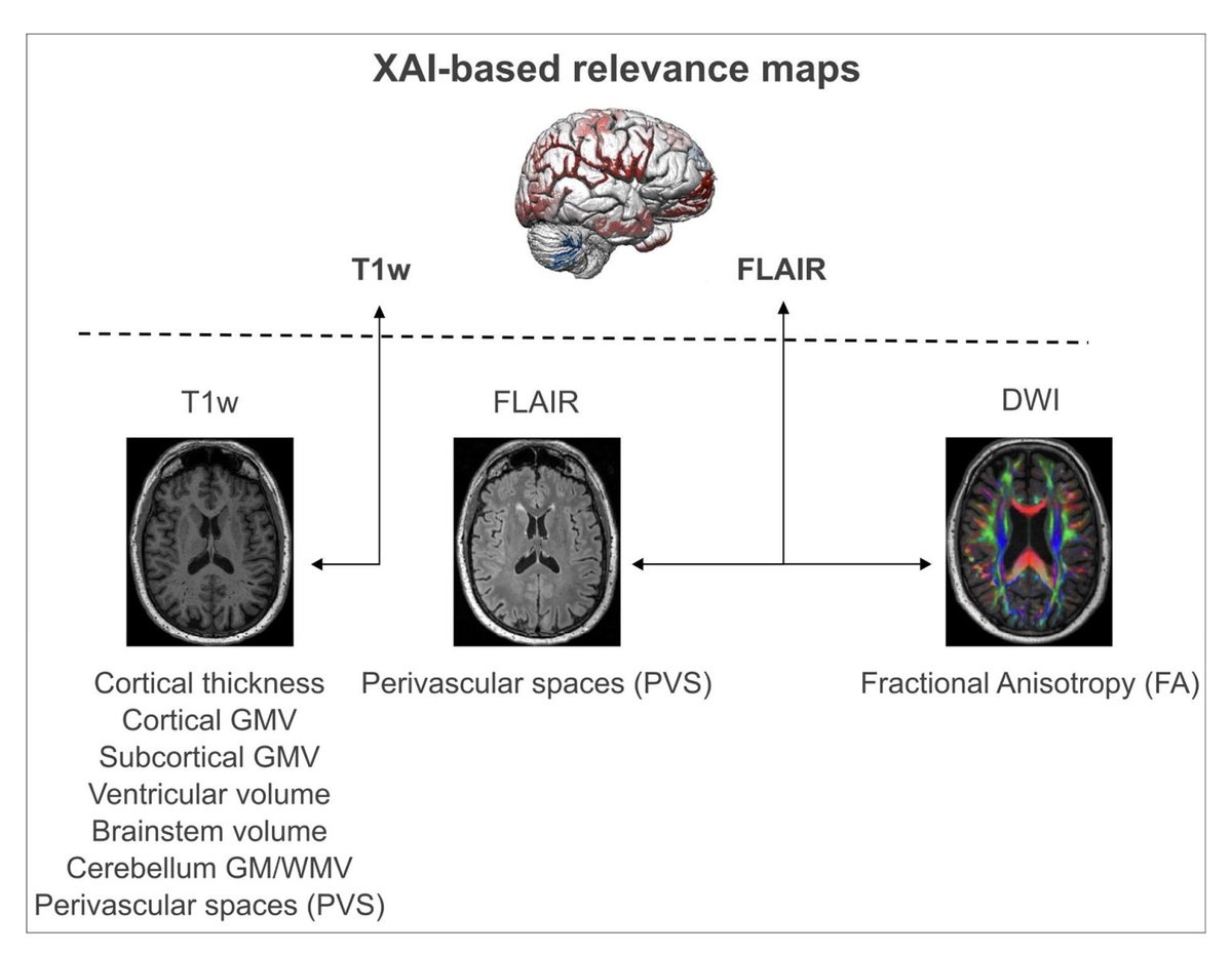 DailyHealthcareAI (@aipulserx) on Twitter photo "The utility of explainable A.I. for MRI analysis: Relating model predictions to neuroimaging features of the aging brain" <a href="/biorxivpreprint/">bioRxiv</a> <a href="/MPI_CBS/">MPI für Kognitions- & Neurowissenschaften</a>
Abstract
Deep learning models highly accurately predict brain-age from MRI but their explanatory capacity is limited. Explainable "The utility of explainable A.I. for MRI analysis: Relating model predictions to neuroimaging features of the aging brain" <a href="/biorxivpreprint/">bioRxiv</a> <a href="/MPI_CBS/">MPI für Kognitions- & Neurowissenschaften</a>
Abstract
Deep learning models highly accurately predict brain-age from MRI but their explanatory capacity is limited. Explainable