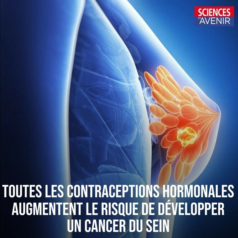 Sciences_Avenir's tweet photo. "Le risque de développer un cancer du sein en prenant une contraception hormonale était 20 à 30% supérieur qu’en son absence, *peu importe le contraceptif utilisé*."

#OctobreRose 
👉 https://t.co/e2lFP3roMG https://t.co/gYjlDcWB1Z