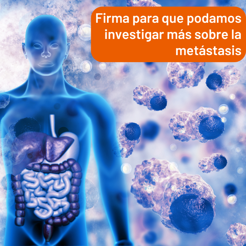 criscancer's tweet photo. La metástasis sucede cuando ciertas células se desprenden del tumor original y crean nuevos tumores en otras partes del organismo.

La 🧑🏻‍🔬 investigación es el único camino para comprender cómo y por qué se produce para poder adelantarnos a su inicio.