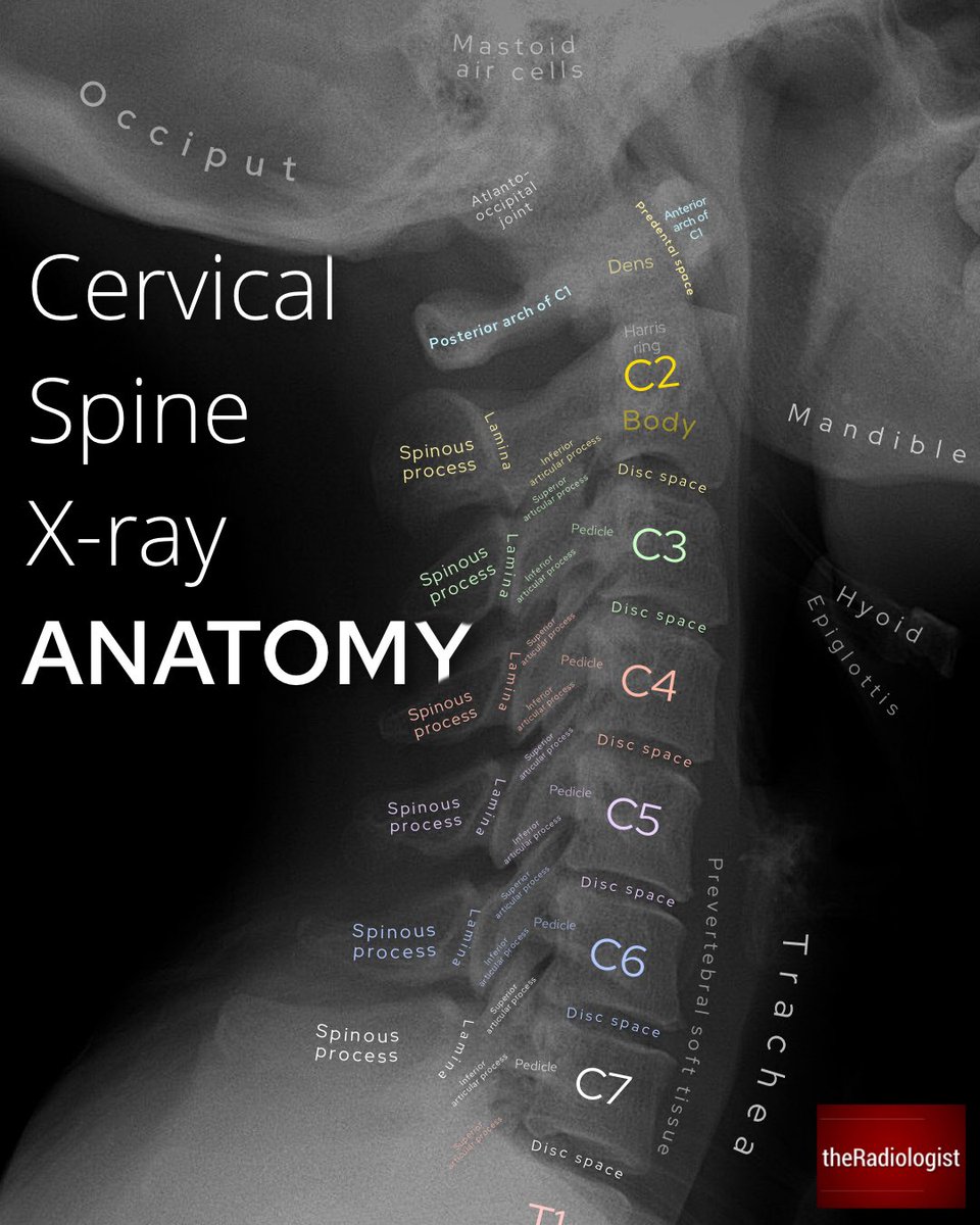 Rayペ-ジ X-Ray anatomy collection: 20 annotated X-Ray images (1/5)
