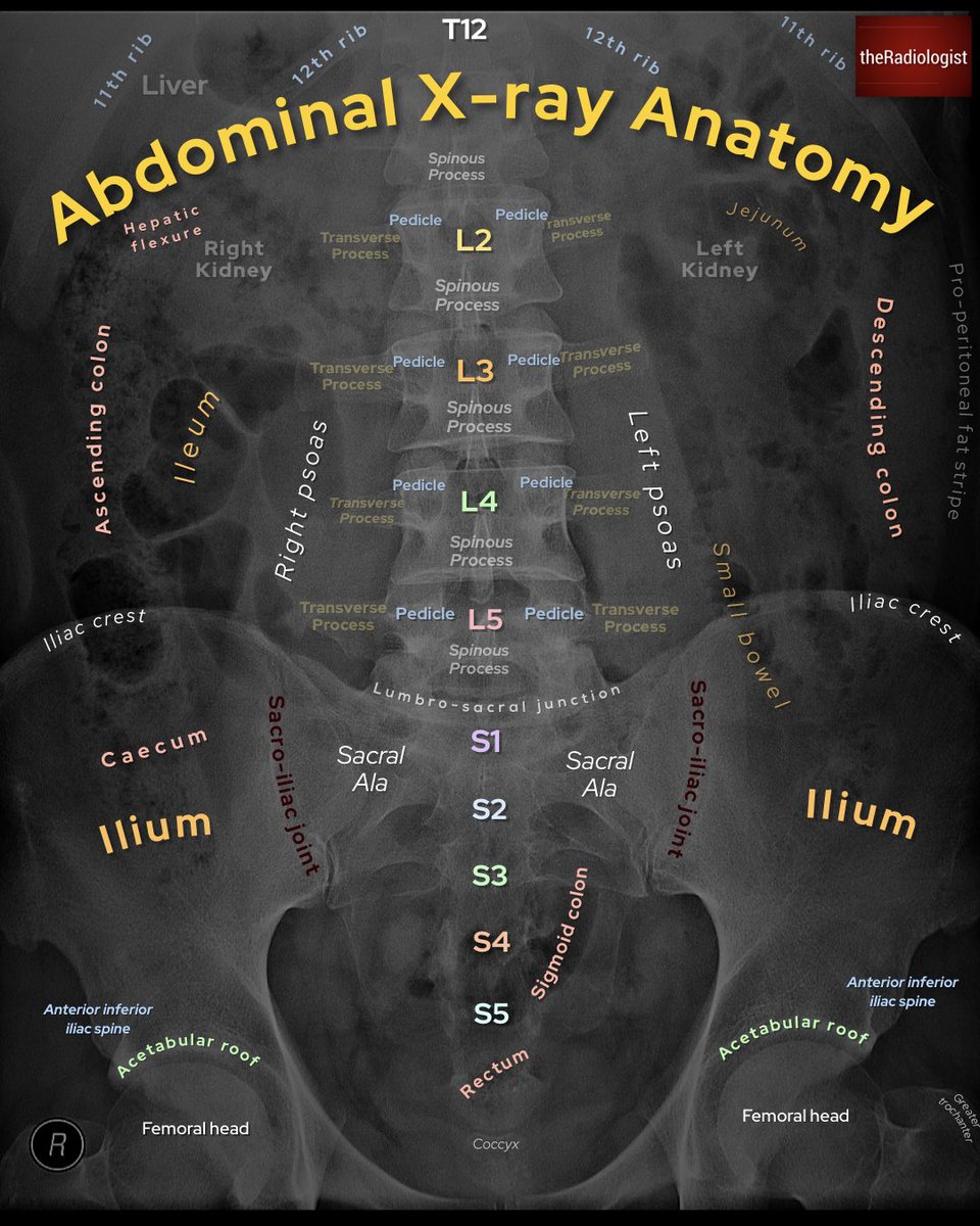 X-Ray anatomy collection: 20 annotated X-Ray images (1/5)