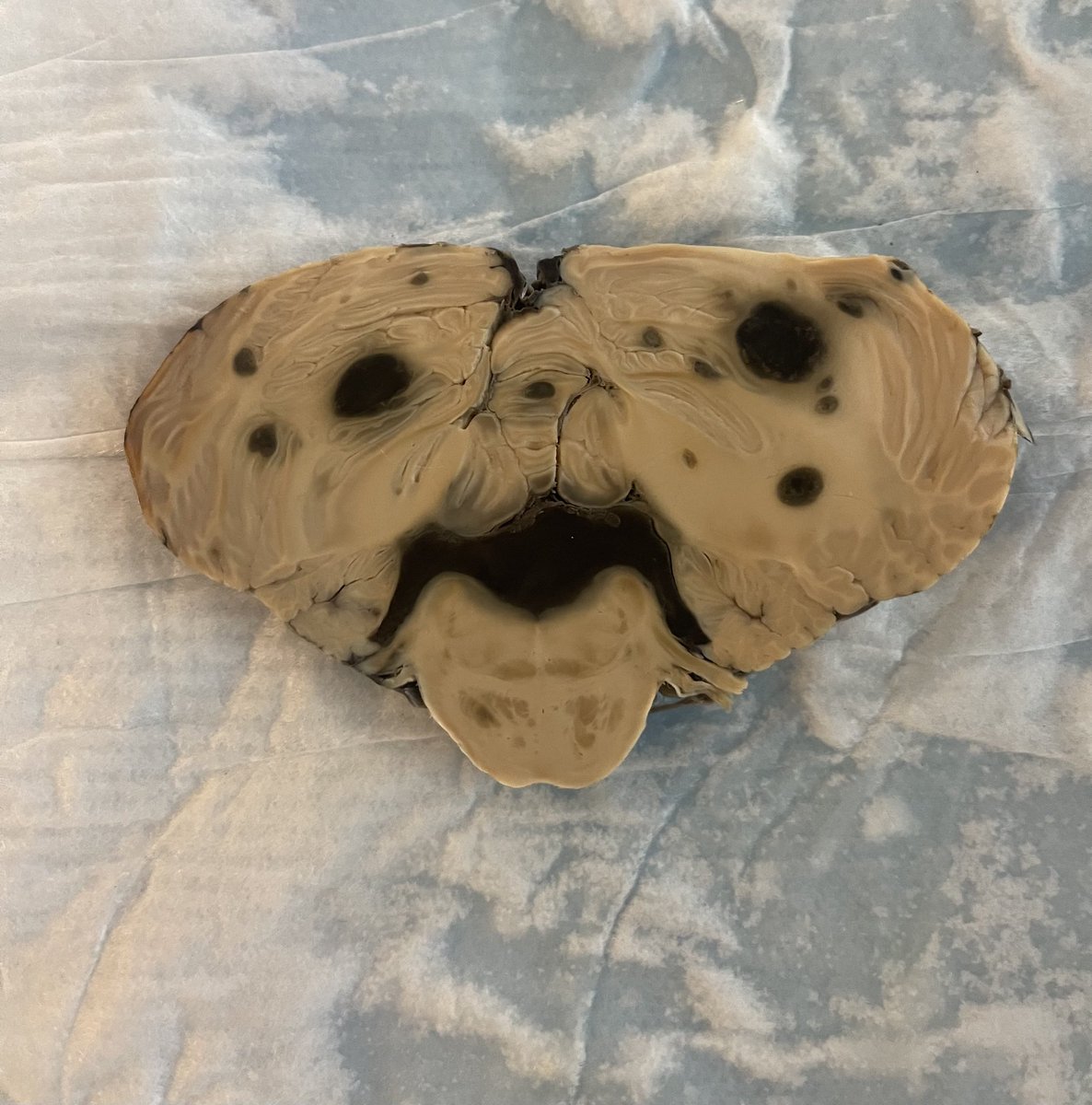 Jamie Walker, MD, PhD tweet media