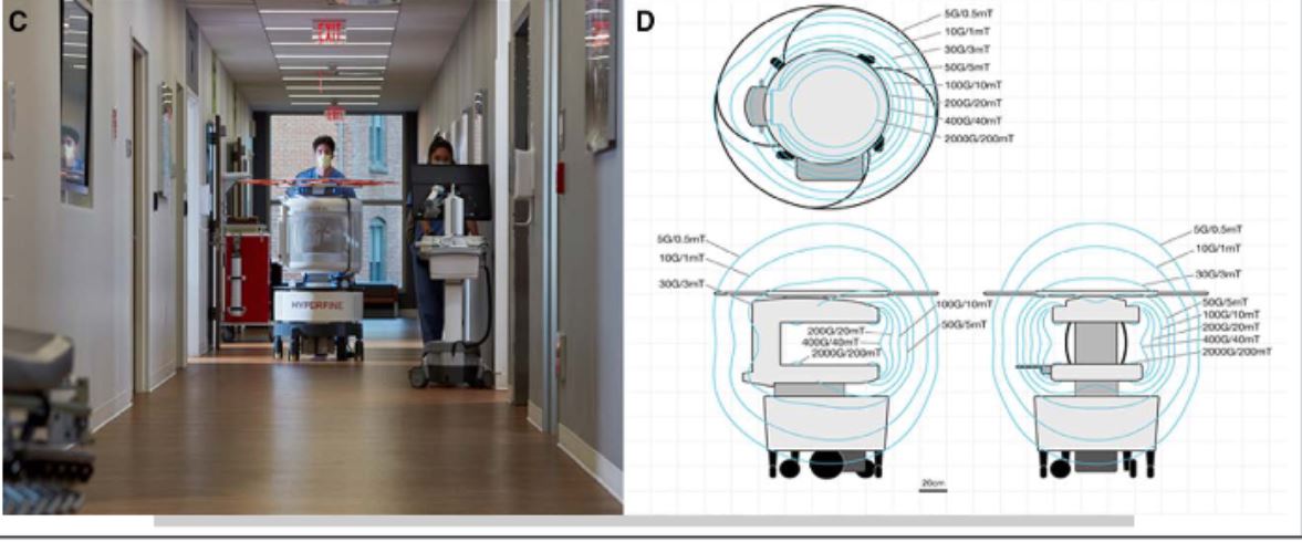 Circulation (@circaha) on Twitter photo Can portable ultra-low-field MRI revolutionize stroke detection in ECMO patients? The multicenter SAFE MRI ECMO study shows it's safe and more sensitive to detect ischemic stroke than CT <a href="/HuimahnChoi/">H Alex Choi</a> <a href="/ErrolBushMD/">Errol L. Bush, MD, FACS</a> <a href="/akkanti/">Bindu Akkanti, MD.</a> <a href="/hsairmd/">Haris Sair</a> <a href="/KhasterDinh/">Kha Dinh</a> <a href="/csmfisher/">Sung-Min Cho</a> ahajournals.org/doi/abs/10.116… Can portable ultra-low-field MRI revolutionize stroke detection in ECMO patients? The multicenter SAFE MRI ECMO study shows it's safe and more sensitive to detect ischemic stroke than CT <a href="/HuimahnChoi/">H Alex Choi</a> <a href="/ErrolBushMD/">Errol L. Bush, MD, FACS</a> <a href="/akkanti/">Bindu Akkanti, MD.</a> <a href="/hsairmd/">Haris Sair</a> <a href="/KhasterDinh/">Kha Dinh</a> <a href="/csmfisher/">Sung-Min Cho</a> ahajournals.org/doi/abs/10.116…
