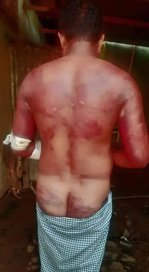 A #Meitei Pangal #commando, who had returned home from the Moreh CDO post, was brutally beaten by #Kukinarcoterrorist today, 1st October 2024.