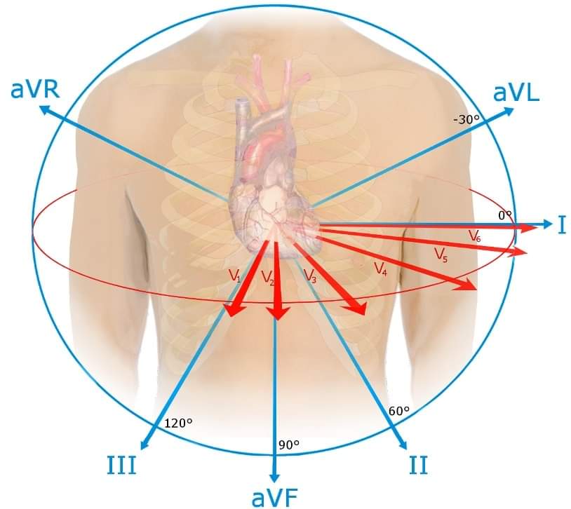 ZHeart11768530's tweet photo. 🔴Introduction to The #ECG⤵️
🔹https://t.co/8Hvn5Uf9bp
#ecg #ekg #cardiology #ecginterpretation #electrocardiograma #electrocardiogram #nursing #cardiologista #healthy #interpretation #heart #nurse #knowledgeofecg #hearts #heartbeat #ccu #cardio #cardiovascular https://t.co/NuXHHWg87G