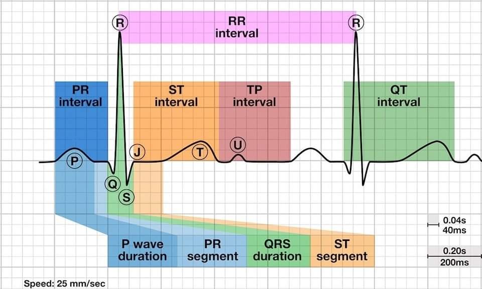 ZHeart11768530's tweet photo. 🔴Introduction to The #ECG⤵️
🔹https://t.co/8Hvn5Uf9bp
#ecg #ekg #cardiology #ecginterpretation #electrocardiograma #electrocardiogram #nursing #cardiologista #healthy #interpretation #heart #nurse #knowledgeofecg #hearts #heartbeat #ccu #cardio #cardiovascular https://t.co/NuXHHWg87G