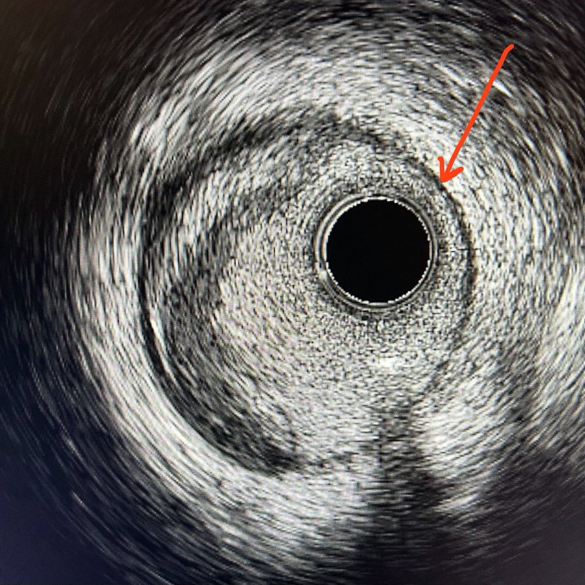 Richard Sohn MD tweet media