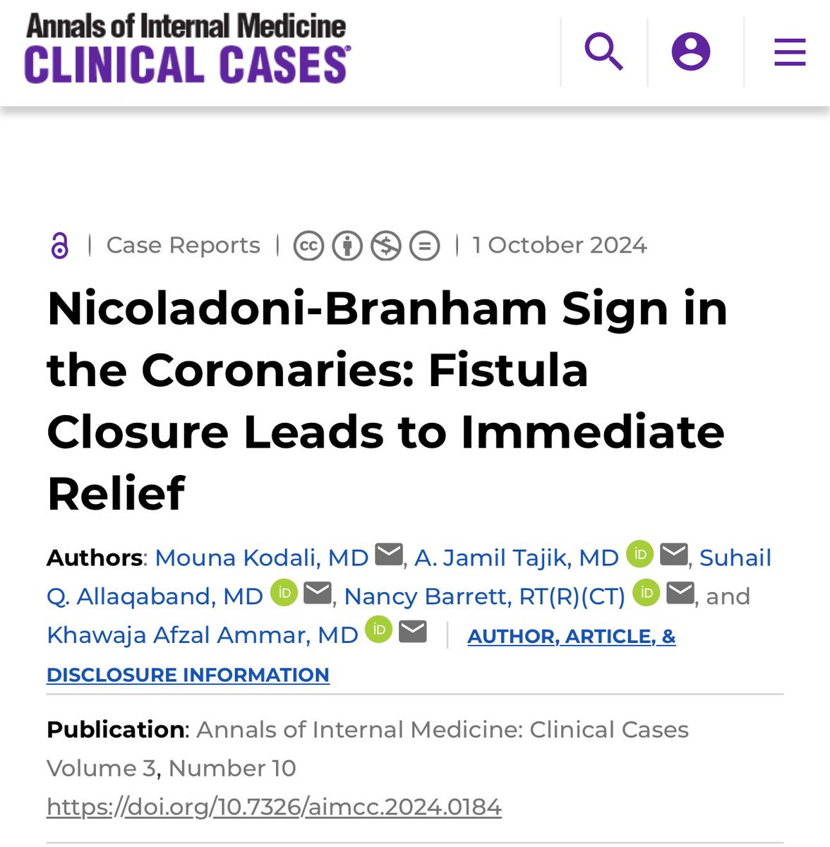 Mouna Kodali (@mounakodali) on Twitter photo New publication alert!
Nicoladoni-Branham sign after closure of an SVC to RCA fistula
Thank you to Dr. Ammar, Dr. Allaqaband, Dr. Tajik for your help! Couldn’t have done it without your mentorship!
<a href="/AllaqabanSuhail/">Suhail Allaqaband</a> <a href="/AJamilTajik/">Abdul Jamil Tajik</a>
<a href="/AnnalsofIM/">Annals of Int Med</a>
<a href="/CircAHA/">Circulation</a>
urldefense.com/v3/__https://w…$ New publication alert!
Nicoladoni-Branham sign after closure of an SVC to RCA fistula
Thank you to Dr. Ammar, Dr. Allaqaband, Dr. Tajik for your help! Couldn’t have done it without your mentorship!
<a href="/AllaqabanSuhail/">Suhail Allaqaband</a> <a href="/AJamilTajik/">Abdul Jamil Tajik</a>
<a href="/AnnalsofIM/">Annals of Int Med</a>
<a href="/CircAHA/">Circulation</a>
urldefense.com/v3/__https://w…$