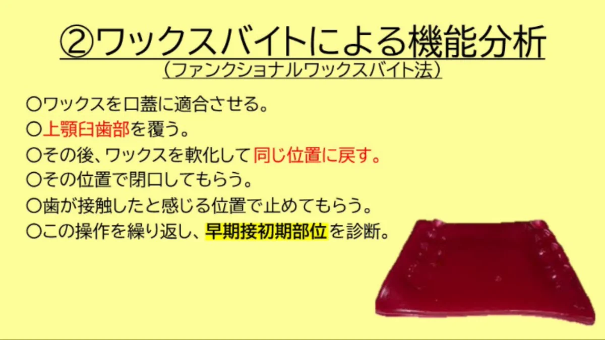 歯科医師国家試験対策 ロムニーハウス勉強会【講師 Dr.N】 on X