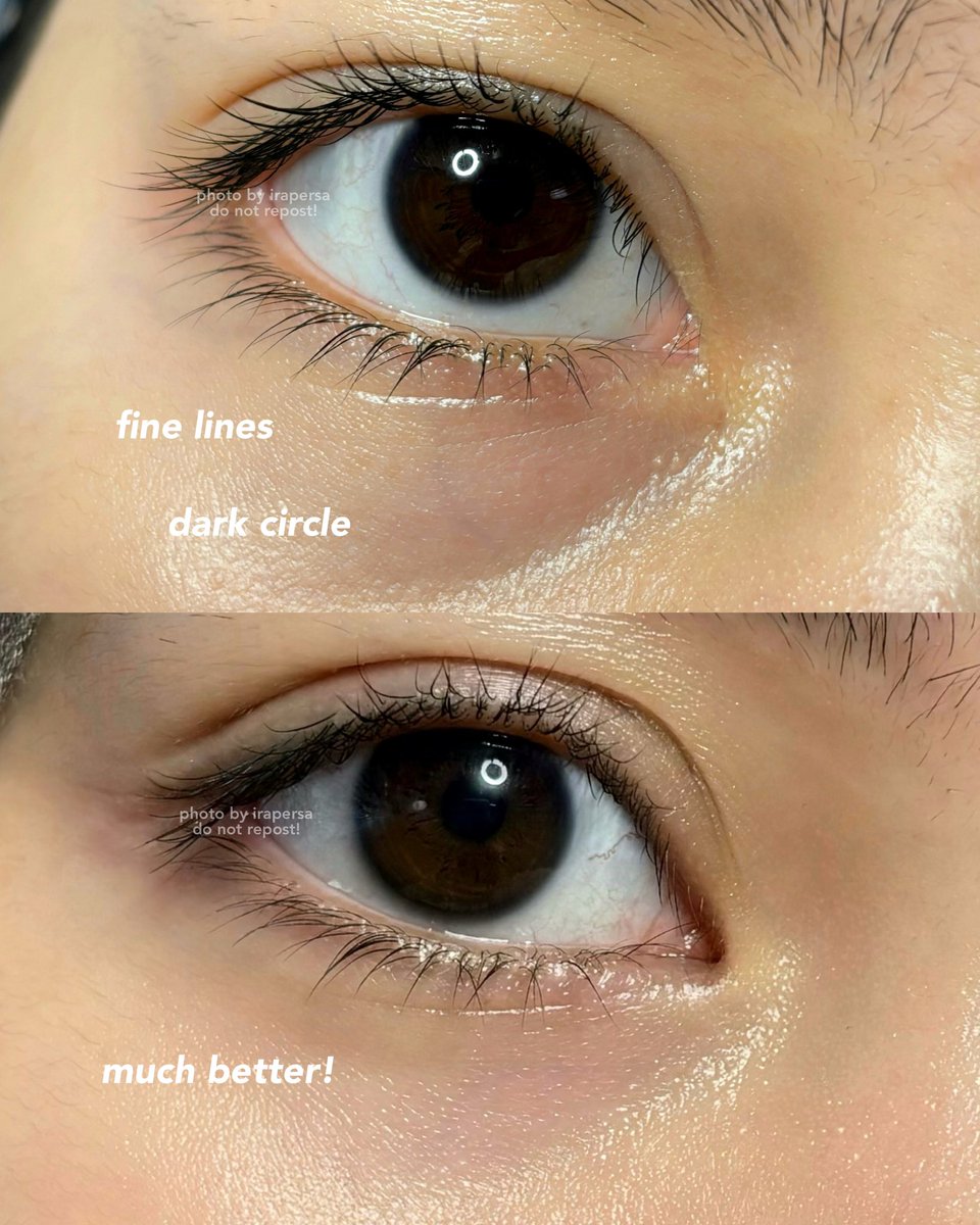 irapersa's tweet photo. EYE &amp; FACE CREAM INI GAME CHANGER DEH MENURUTKU🫨

lately lagi suka begadang sama depan layar terus kerjaannya, jadi ada mata panda &amp; fine lines di sekitar mata.

anyway ini bisa dipake buat kerutan di leher juga. https://t.co/Ci896CVgG1