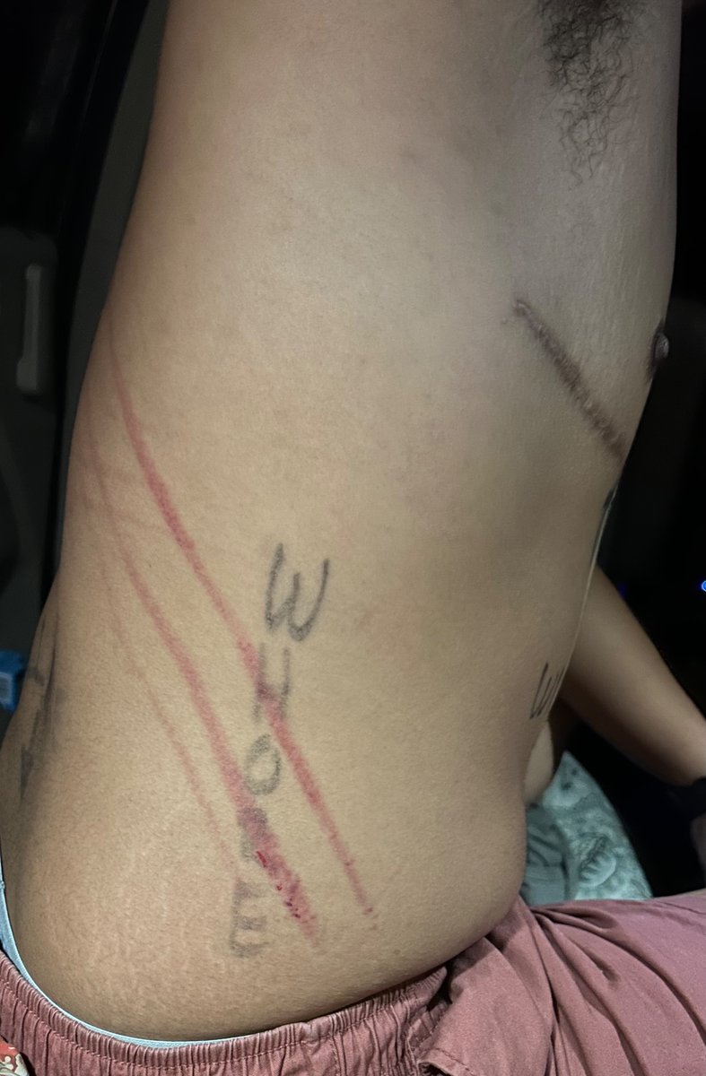 Wedgiebitchboy's tweet photo. #Folsom2024 aftermath 
My boyfriend hand fun writing all over me #publichumiliation
#bullyme #loser #whore #degredation #bdsm https://t.co/Dqi2cT4RkE