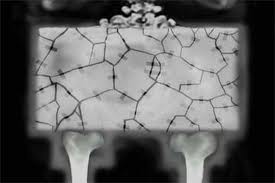 I need a bady with an ass so fat, that my pelvis looks like this afterwards.