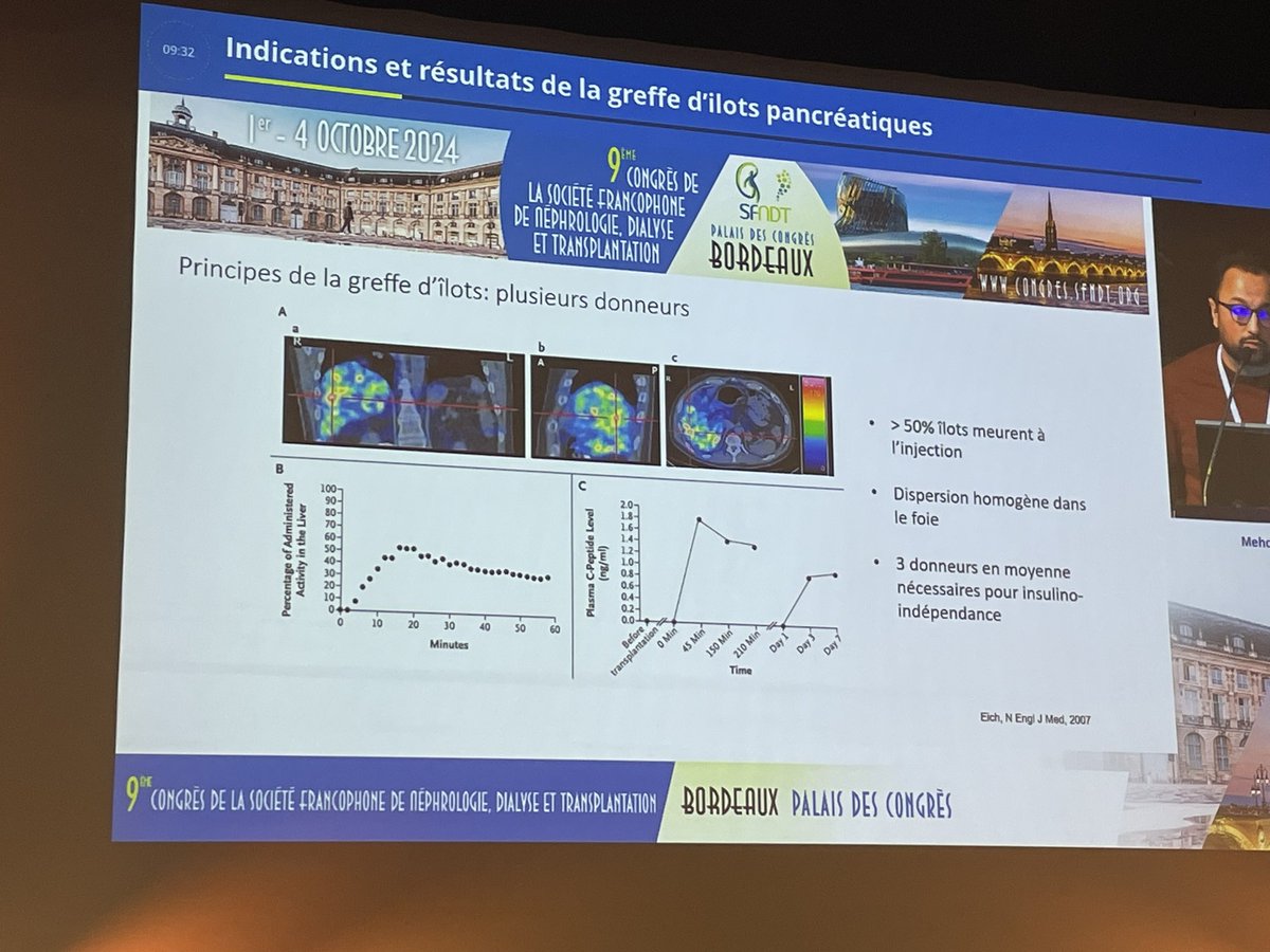 LucileFigueres's tweet photo. Greffe d’îlots pancréatiques par le GOAT @MaanaouiMehdi ! #SFNDT2024 
- 2-3 donneurs nécessaires pour une efficacité suffisante (insuline-indépendance)
- Étude KAIAK : moins efficace que transplantation pancréatique mais…. 1/2 

https://t.co/PuhkzjX2f2 https://t.co/hg4Ce2HTtP