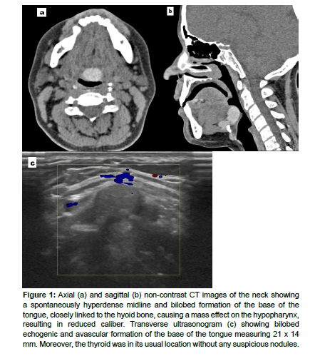 omicsrad tweet picture